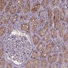 Immunohistochemical staining of human kidney shows moderate granular cytopalsmic positivity in cells in tubules.