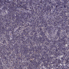 Immunohistochemical staining of human tonsil shows no positivity in non-germinal center cells as expected.