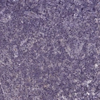 Immunohistochemical staining of human tonsil shows no positivity in non-germinal center cells as expected.
