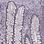 Immunohistochemical staining of human rectum shows no positivity in glandular cells as expected.