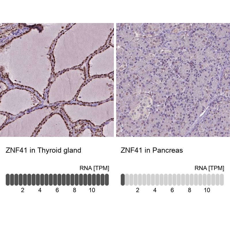 Anti-ZNF41 Antibody