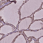 Immunohistochemical staining of human thyroid gland shows high expression.