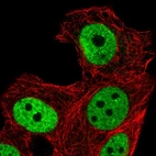 Immunofluorescent staining of human cell line MCF7 shows localization to nucleoplasm.