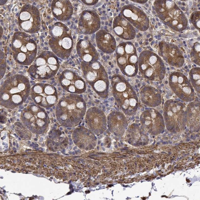 Anti-PCID2 Antibody