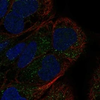 Immunofluorescent staining of human cell line RT-4 shows localization to vesicles.