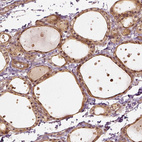 Anti-VEGFA Antibody