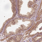 Immunohistochemical staining of human prostate shows moderate cytoplasmic and membranous positivity in glandular cells.