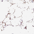 Immunohistochemical staining of human adipose tissue shows moderate cytoplasmic positivity in adipocytes.