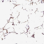 Immunohistochemical staining of human adipose tissue shows moderate cytoplasmic positivity in adipocytes.