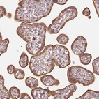 Immunohistochemical staining of human placenta shows moderate cytoplasmic positivity in trophoblastic cells.