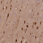 Anti-VEGFA Antibody