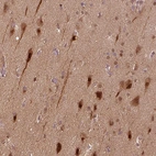 Immunohistochemical staining of human cerebral cortex shows strong cytoplasmic positivity in neurons.