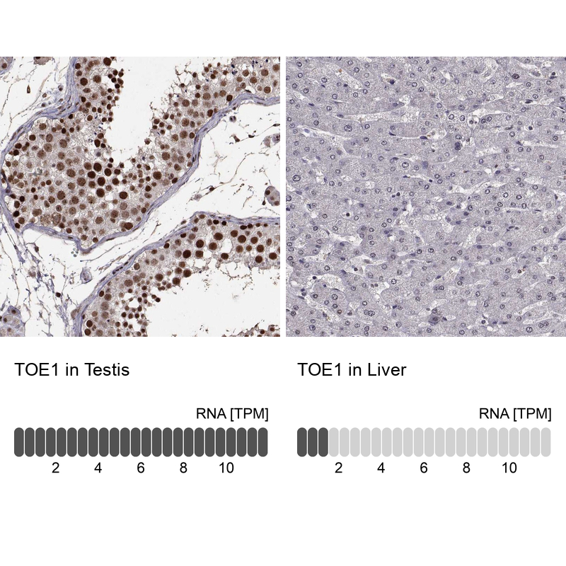 Anti-TOE1 Antibody