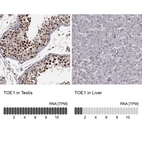 Anti-TOE1 Antibody