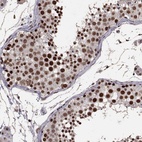 Immunohistochemical staining of human testis shows high expression.