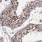 Immunohistochemical staining of human testis shows high expression.