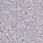 Immunohistochemical staining of human liver shows low expression as expected.