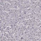 Immunohistochemical staining of human liver shows low expression as expected.