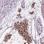 Immunohistochemical staining of human testis shows strong granular cytoplasmic positivity in Leydig cells.