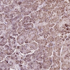 Immunohistochemical staining of human pancreas shows moderate granular cytoplasmic positivity in exocrine glandular cells.