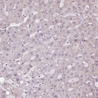 Immunohistochemical staining of human liver shows very weak granular cytoplasmic positivity in hepatocytes.
