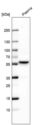 Western blot analysis in human plasma.
