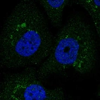 Immunofluorescent staining of human cell line HaCaT shows localization to vesicles.