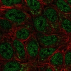 Immunofluorescent staining of human cell line RT4 shows localization to nucleoplasm & vesicles.