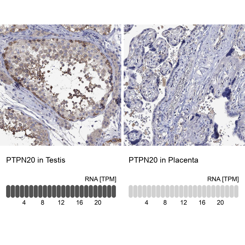Anti-PTPN20 Antibody