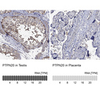 Anti-PTPN20 Antibody
