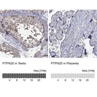 Anti-PTPN20 Antibody