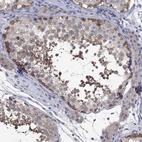 Immunohistochemical staining of human testis shows high expression.