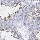 Immunohistochemical staining of human testis shows high expression.