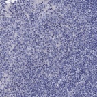 Anti-CETN1 Antibody