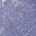Immunohistochemical staining of human tonsil shows low expression as expected.