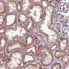 Immunohistochemical staining of human kidney shows strong cytoplasmic positivity in cells in tubules.