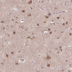 Immunohistochemical staining of human cerebral cortex shows strong cytoplasmic positivity in neurons.