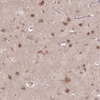Immunohistochemical staining of human cerebral cortex shows strong cytoplasmic positivity in neurons.