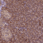 Immunohistochemical staining of human pancreas shows strong cytoplasmic positivity in exocrine glandular cells.