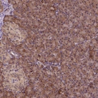 Immunohistochemical staining of human pancreas shows strong cytoplasmic positivity in exocrine glandular cells.