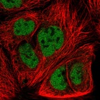Immunofluorescent staining of human cell line CACO-2 shows localization to nucleoplasm.
