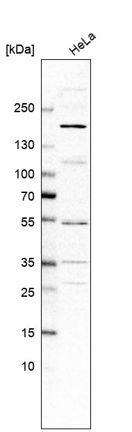 Anti-ADGRB2 Antibody