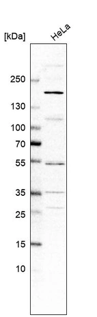 Anti-ADGRB2 Antibody