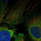 Immunofluorescent staining of human cell line HeLa shows localization to plasma membrane.