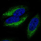 Anti-CCR10 Antibody