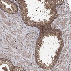 Anti-ZNF226 Antibody