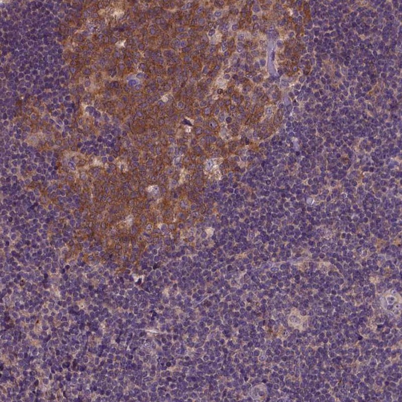 Anti-KBTBD8 Antibody