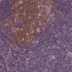 Anti-KBTBD8 Antibody