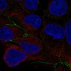 Anti-CGNL1 Antibody