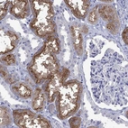 Immunohistochemical staining of human kidney shows strong membranous and cytoplasmic positivity in cells in tubules.